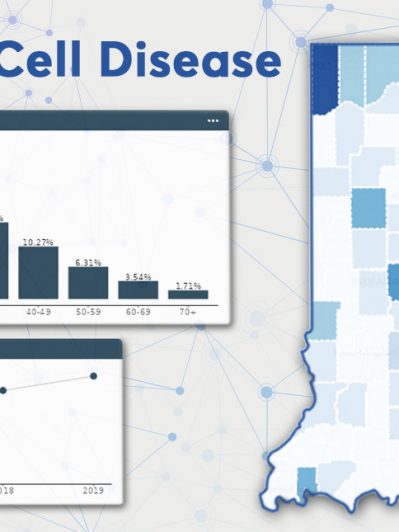 Bringing data to life: New interactive dashboard provides analysis and visualization of sickle cell disease prevalence and burden in an entire state